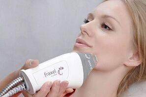 ماهیت روش جوانسازی پوست صورت کسری