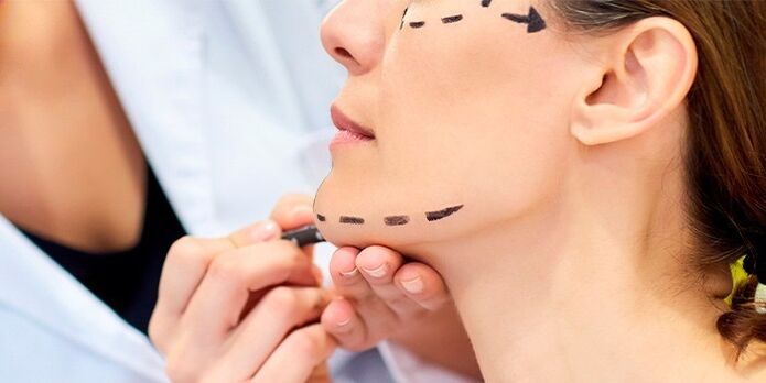 پزشک بیمار را برای جراحی آماده می کند